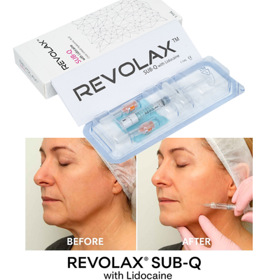 OEM 1.1ml Revolax Fein-Tiefe-Sub-Q-Leichtgewicht-Füllmittel für feine Linien und subtile Hautverjüngung