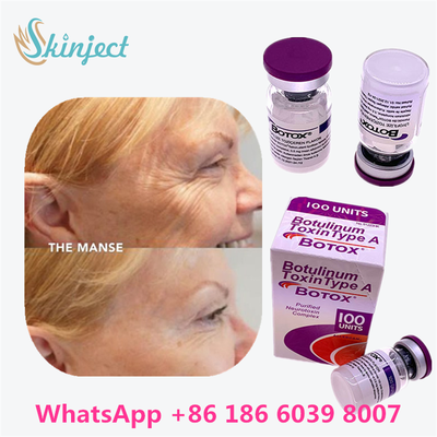 Botulinumtoxin BOTOX Kosmetik 100 Einheiten Allergan OnabotulinumtoxinA für Gesichtsfalten