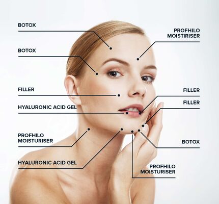 64 mg Hochkonzentration Anti-Aging-Behandlung (1x2ml) Profhilo H+L Bio-Remodeling Injektionsfiller für die Haut