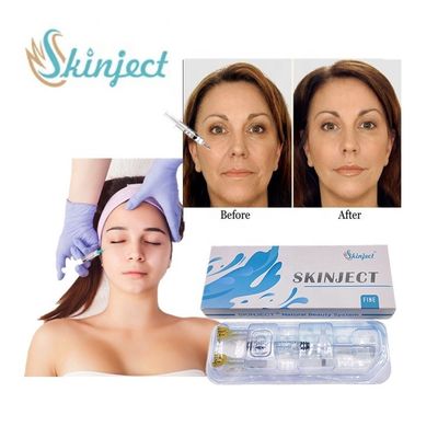 Feiner Hyaluronsäure-Füller-alternder Antifalten-Einspritzungs-Hautantifüller Skinject 1ml