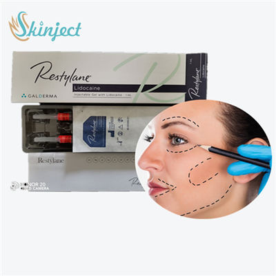 FÜLLER-Lippeneinspritzungen  Haut, Lippenfüller der Hyaluronsäure-1ml