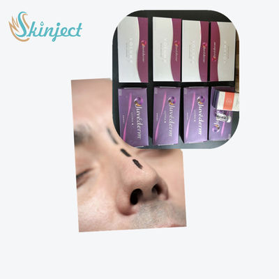 Verbundener Hyaluronsäure-Hautquerfüller Juvederm ultra 3 ultra 4 Voluma