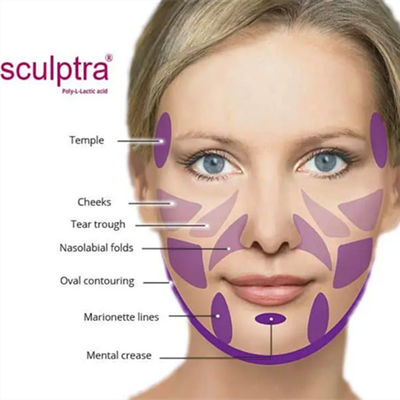 Pulver CER PLLA für regt Kollagen an