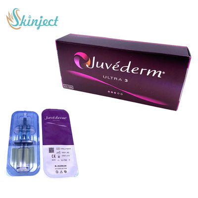 Juvederm ultra 3 Lippenfüller-Hyaluronsäure-dermaleinjizierbare