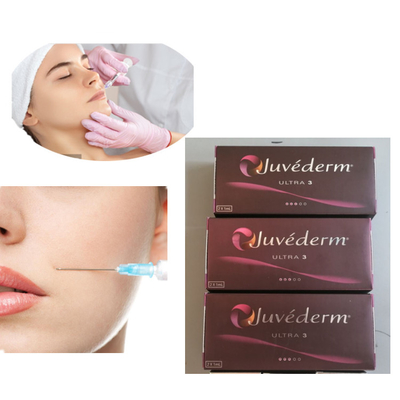 Einspritzung Juvederm 2x1ml ultra 3 Lippenhautfüller 24mg/Ml