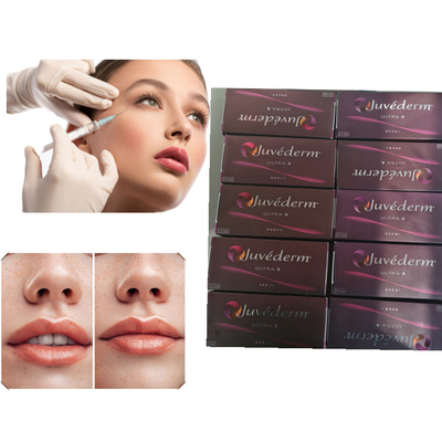 Lippengel-Füller-Hyaluronsäure-Hautfüller Juvederm ultra 3 ultra 4