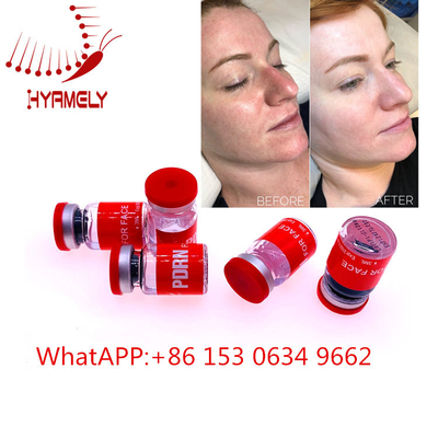 Alternde Mesoserum-Antieinspritzung mit Hyaluron Pen Dermal Filler