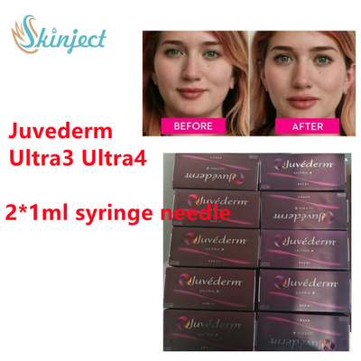 Juvederm-Hyaluronsäure-Hautfüller Juvederm-Lippenfüller mit  2x1ml Ultra3 Ultra4