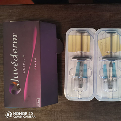 Hyaluronsäure-Hautfüller Juvederm Ultra3 für Lippen