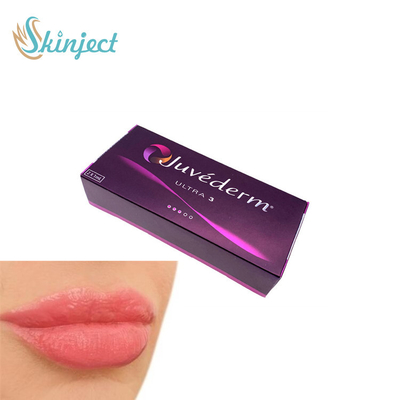 Gesichts-füllender Lippenfüller Juvederm ultra 3 Hyaluronsäure-Hautfüller