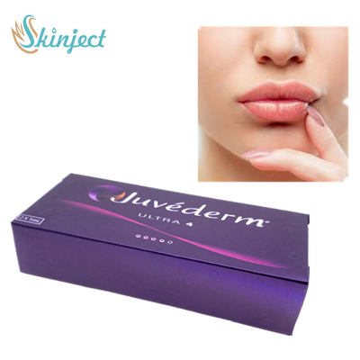 Hautfüller ultra 4 Juvederm für Lippen enthäuten Hautfüller-Hyaluronsäure-Hautfüller