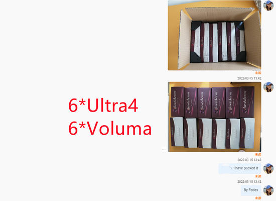 Lippengesicht, das Hyaluronsäure-Hautfüller Juvederm Ultra4 Voluma formt