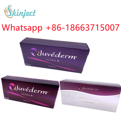 Hyaluronsäure-Lippenfüller Juvederm Ultra3 Ultra4 injizierbar