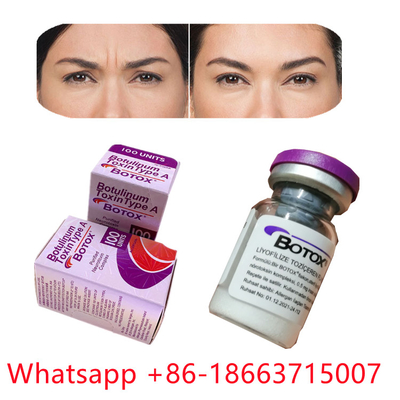 Botulinumgiftstoff-Art Allergan eine -Pulver-Form