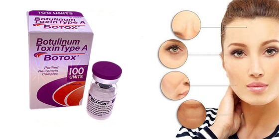 Botulinumgiftstoff-Art Allergan eine -Pulver-Form