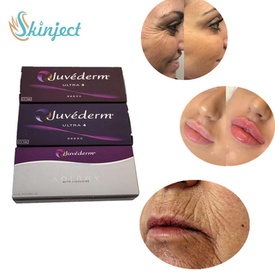 Juvederm ultra 4 Hautfüller-Lippeneinspritzungen für sexy Lippenverbesserung