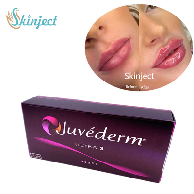 Hyaluronsäure-Gesichtsfüller Juvederm Ultra3 2x1ml Haut