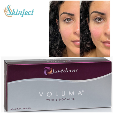 Hautfüller Juvederm Voluma 2x1ml ha für Wangenknochen Chin Contouring