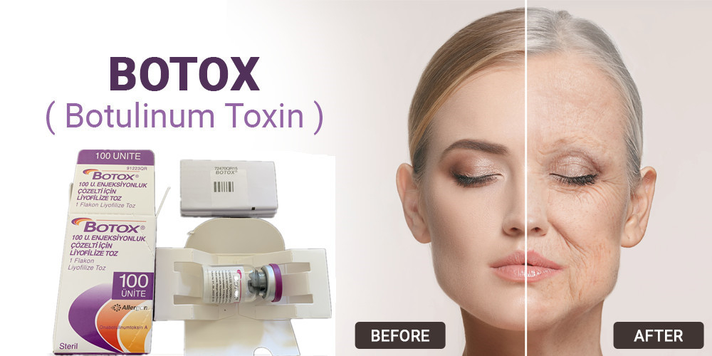 Botulinumgiftstoff-Art 100Units Allergan eine Einspritzung für Gesichtsfalten-Abbau