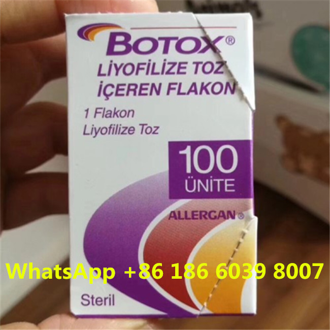 Botulinumgiftstoff Allergan-Einspritzung  einen 100 Einheits-Falten-Abbau schreiben