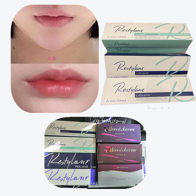 Verknüpfte Hyaluronsäure Hautfüllmittel Antiaging-Produkte