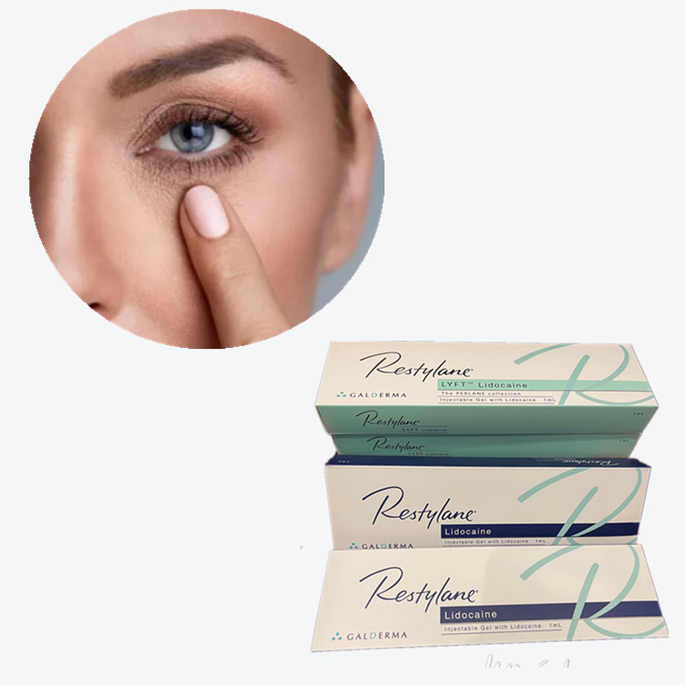 Hyaluronsäure-Füllmittel HA-Füllmittel für das Gesicht