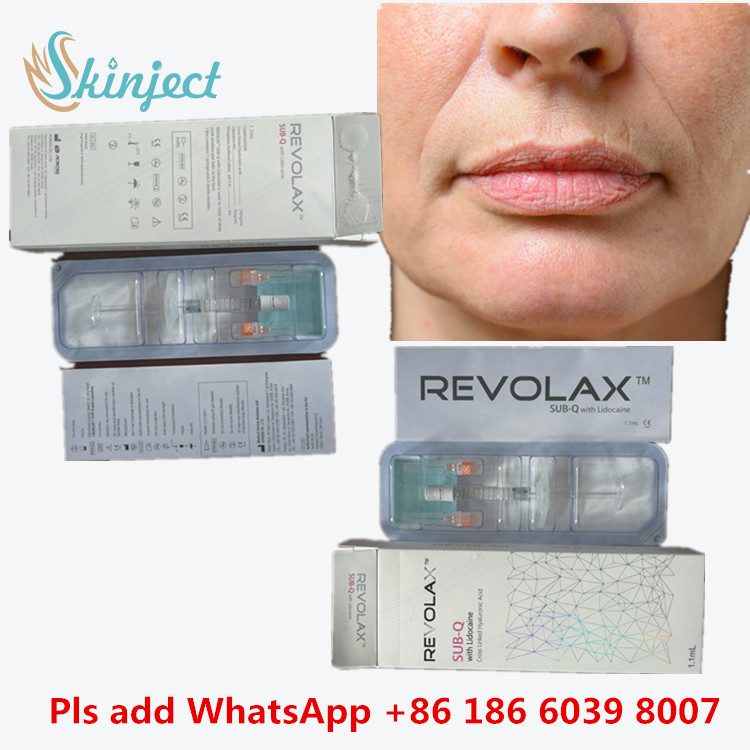 Medizinisches Natriumhyaluronat Gel Hyaluronsäure Dermal Revolax Tieffüllmittel 1 ml zur Lippeninjektion