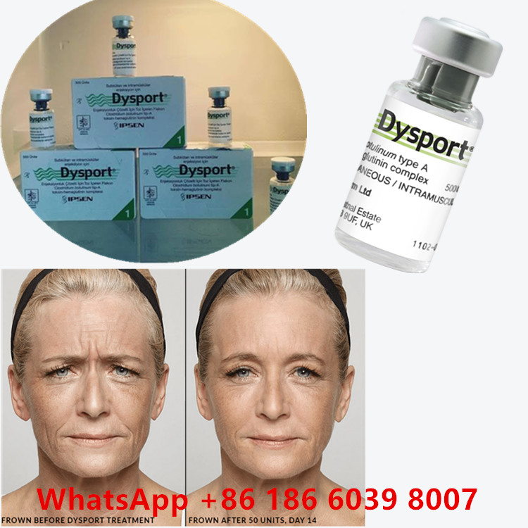 Botulinumtoxin 100 Einheiten BTX Injektion Typ A Kosmetische Anwendung
