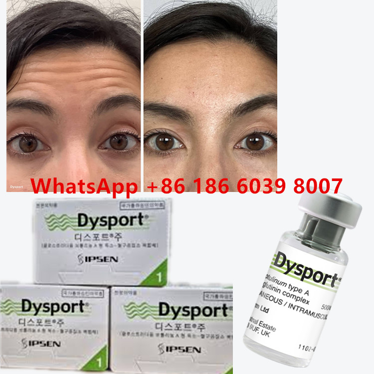 Botulinumtoxin-Dysport Clostridium Botulinum Typ A 500 Einheiten/ Durchstechflasche