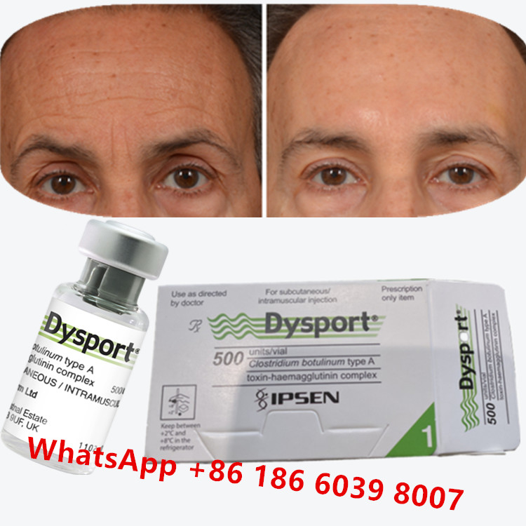 Botulinumtoxin Dysport Clostridium Botulinum Typ A für Krähenfüße