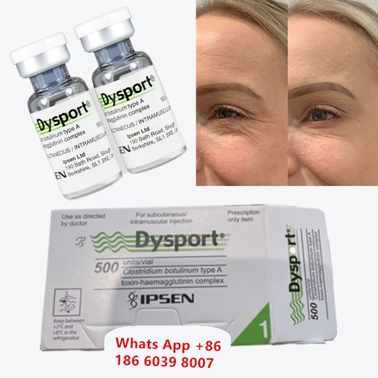 Dysport Botulinumtoxin Typ A für Tränenfurchenfalten