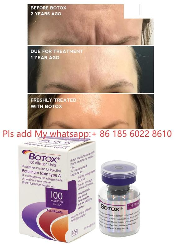 Allergan Botox 100IU Dysport Injektion Botulax Botulinumtoxin Falten entfernen