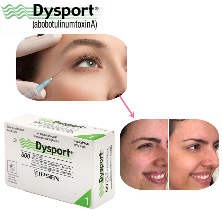 500u Dysport Gesichtsfaltenentfernung Gefriergetrocknetes Pulver Verarbeitung Kundenspezifische OEM Dysport