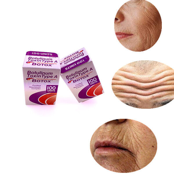 Schönheitssalons Allergen Korea Botulinum Toxin für Anti-Aging und Faltenentfernung