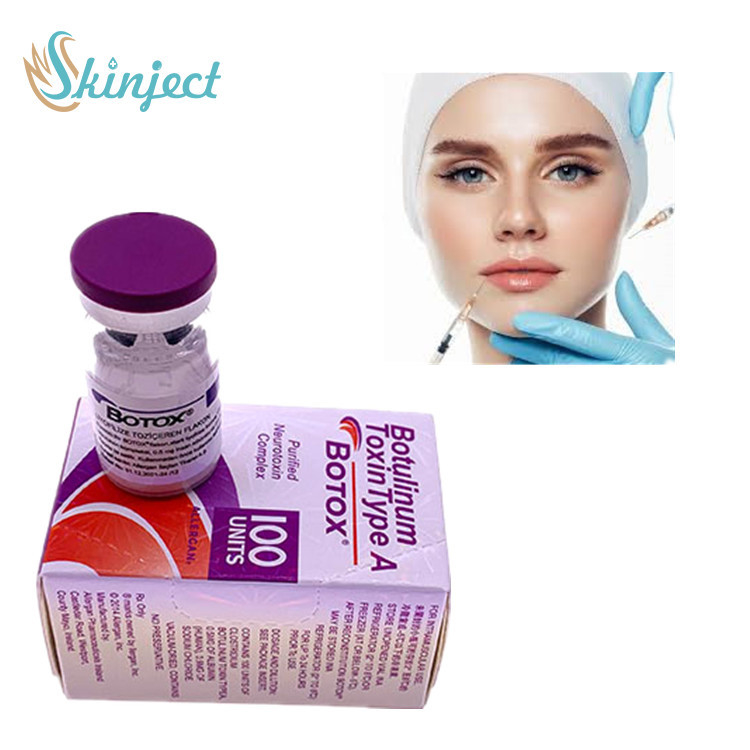 Botulinumgiftstoffart Allergan 100u eine  Hautfüller-Einspritzung