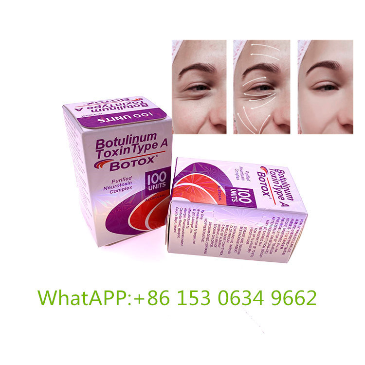 Botulinumgiftstoff-Art ein Hautfüller der Einspritzungs-100Unit Allergan