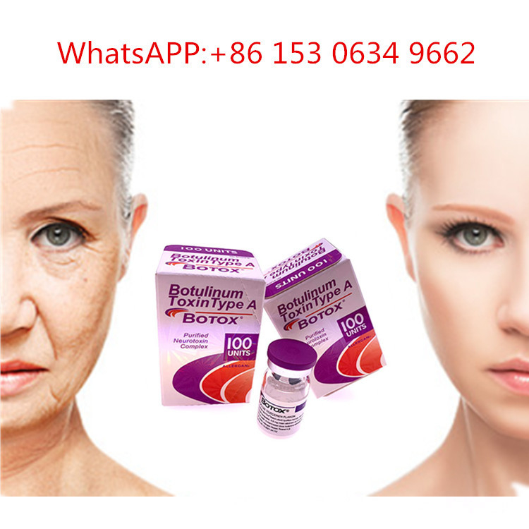 Art 50u 100u 150u ein Einspritzungs-Botulinumgiftstoff Allergan  für Antifalte