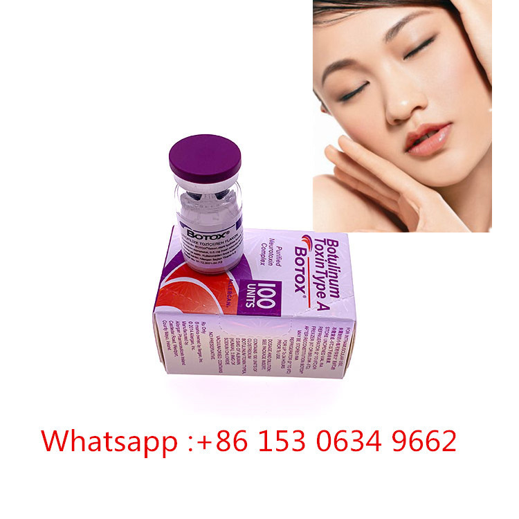 Art ein Hautfüller-Einspritzungs-Botulinumgiftstoff A 100units Allergan