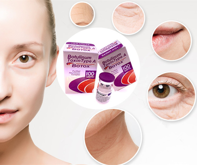 Einheiten Meditoion 50 Botuliunm-Giftstoff-Art 100 Einheiten Allergan