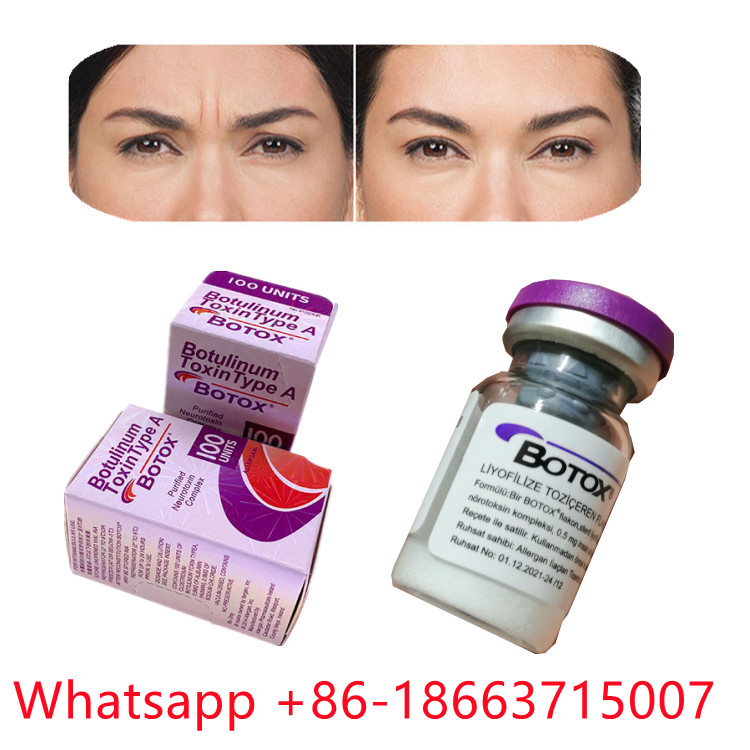 Botulinumgiftstoff-Art Allergan eine -Pulver-Form