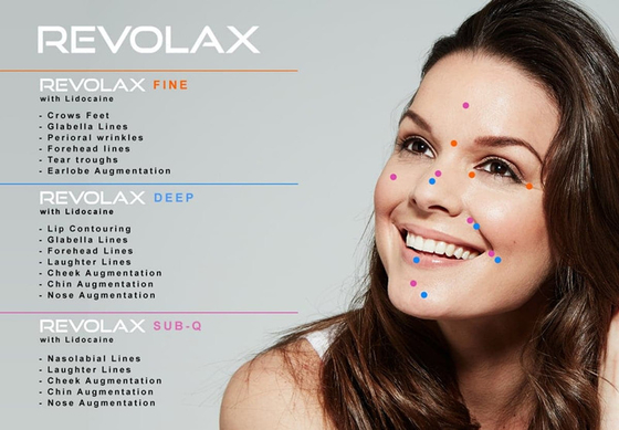 Revolax-Hyaluronsäure-Hautfüller knittert Lippenvermehrung
