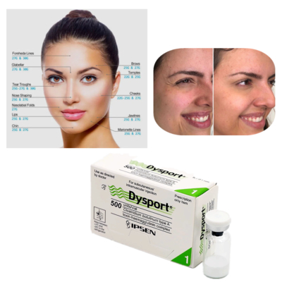 Dysport 500U Botulinumtoxin Typ A zur Faltenbehandlung