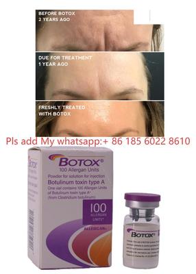 Allergan Botox Injektion Botulax Botulinumtoxin Falten entfernen