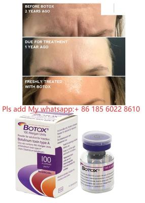 Allergan Botox 100IU Dysport Injektion Botulax Botulinumtoxin Falten entfernen