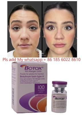 Botulax Botulinum Toxin Dysport Allergan Botox für Faltenreduktion und Kosmetik